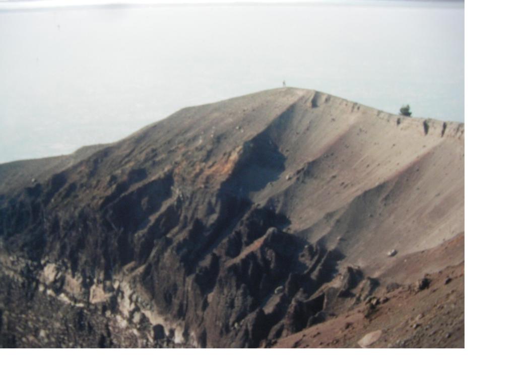 I fianchi interni della bocca..