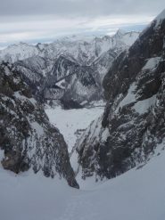 Ematoma sottodurale cronico